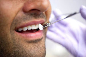 patient receiving dental veneers at Radiant Family Dentistry